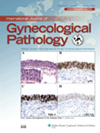 点击查看International Journal Of Gynecological Pathology