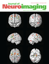 点击查看Journal Of Neuroimaging