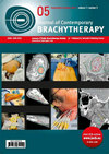 点击查看Journal Of Contemporary Brachytherapy