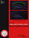 点击查看Journal Of Neurovirology